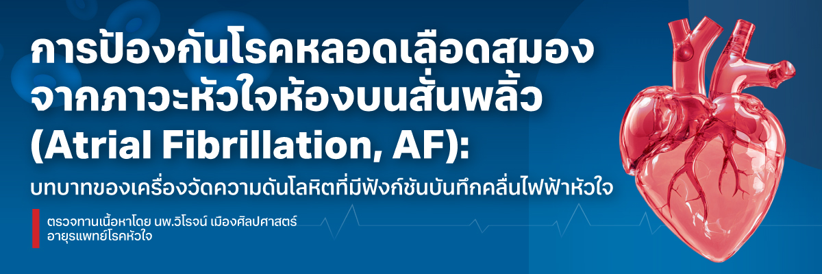 การป้องกันโรคหลอดเลือดสมองจากภาวะหัวใจห้องบนสั่นพลิ้ว (Atrial Fibrillation, AF): บทบาทของเครื่องวัดความดันโลหิตที่มีฟังก์ชันบันทึกคลื่นไฟฟ้าหัวใจ