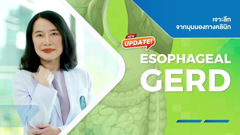 ภาพหน้าปกวิดีโอ ESOPHAGEAL GERD เจาะลึกจากมุมมองทางคลินิก